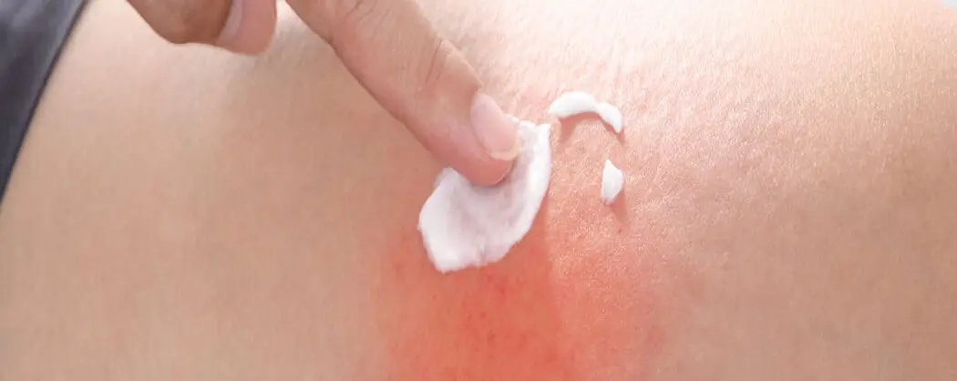 ผลิตภัณฑ์กลุ่มเครื่องมือแพทย์